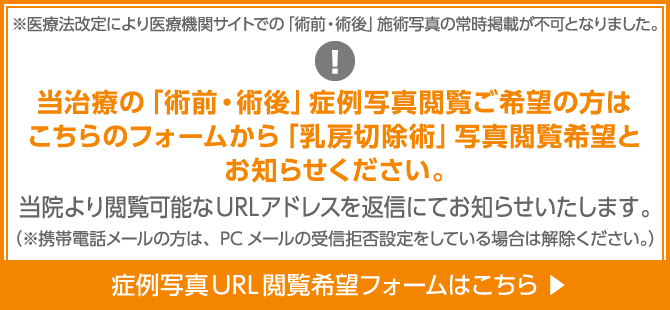 当治療の「術前・術後」症例写真閲覧ご希望の方は下記メールあてに「乳房切除術」写真閲覧希望とお知らせください。